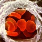 Заболевания крови: виды